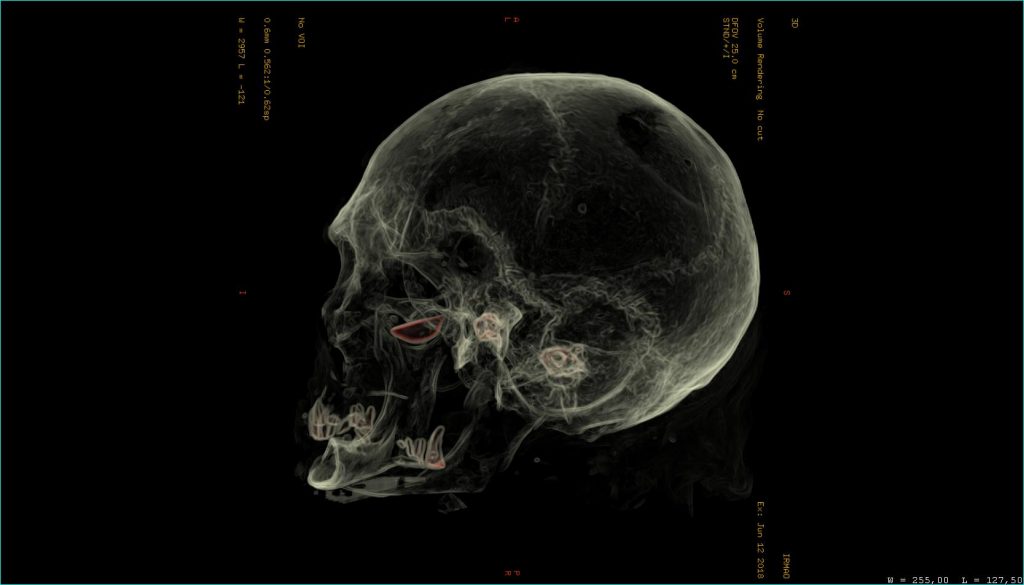 Origin of 2,500-year-old Egyptian mummy proven Tomografia da cabeça da múmia